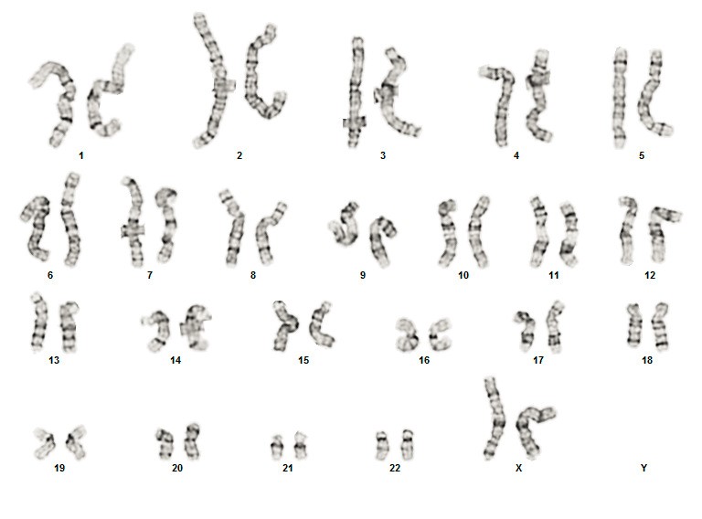 Karyotyping of iPSC Line